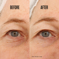 mii cosmetics bright eyed firm smooth hydrogel eye pads oogpads voor een strakkere oogcontour voor en na