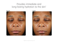 pca skin hyaluronic acid boosting serum before and after