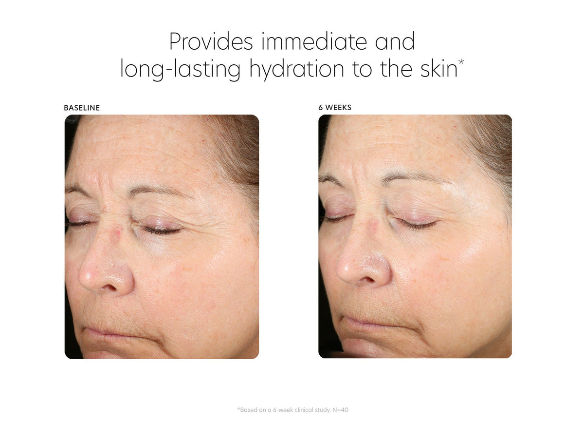 pca skin hyaluronic acid boosting serum voor en na