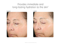 pca skin hyaluronic acid boosting serum voor en na