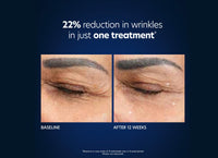 pca skin microneedling hyaluronic acid microneedle eye patches voor en na