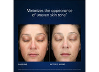 pca skin hydrabright hydration cream voor en na