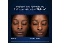 pca skin hydrabright hydration cream before and after