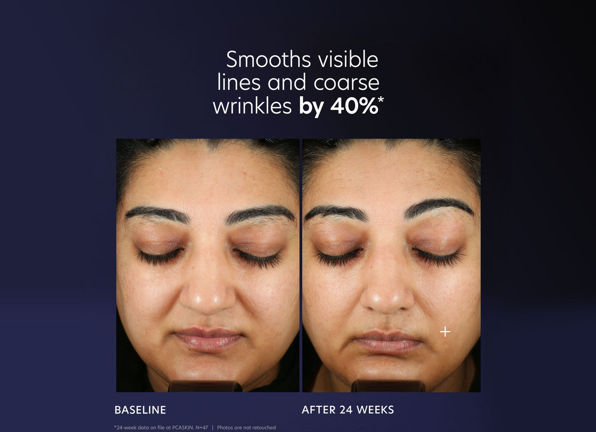 pca skin pro max age renewal serum review