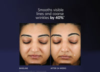 pca skin pro max age renewal serum review