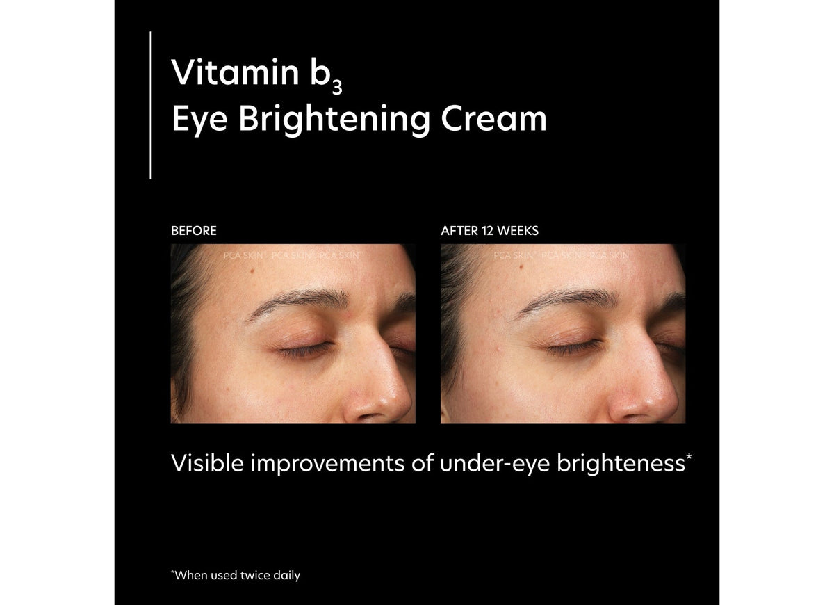 pca skin vitamin b3 eye brightening cream voor en na