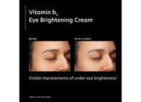 pca skin vitamin b3 eye brightening cream voor en na