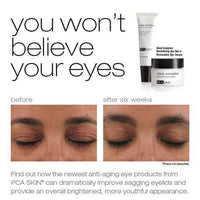 pca skin ideal complex revitalizing eye gel voor en na
