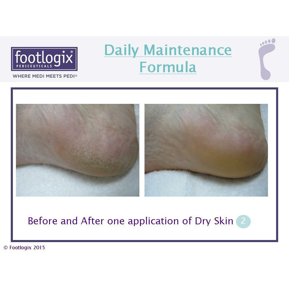 Footlogix | Daily Maintenance Formula