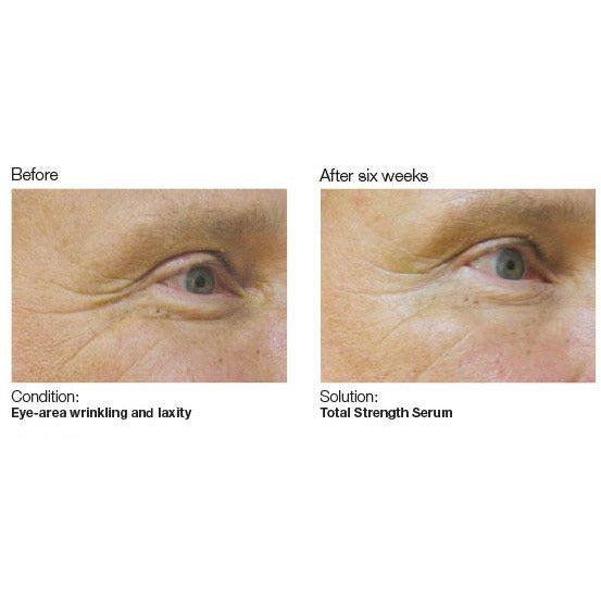 pca skin total strength serum  voor en na