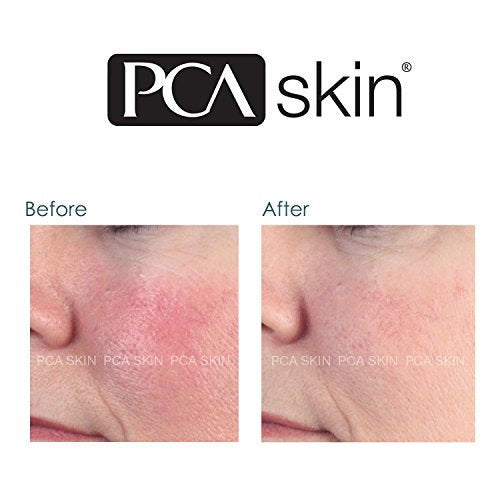 pca skin anti redness serum before and after