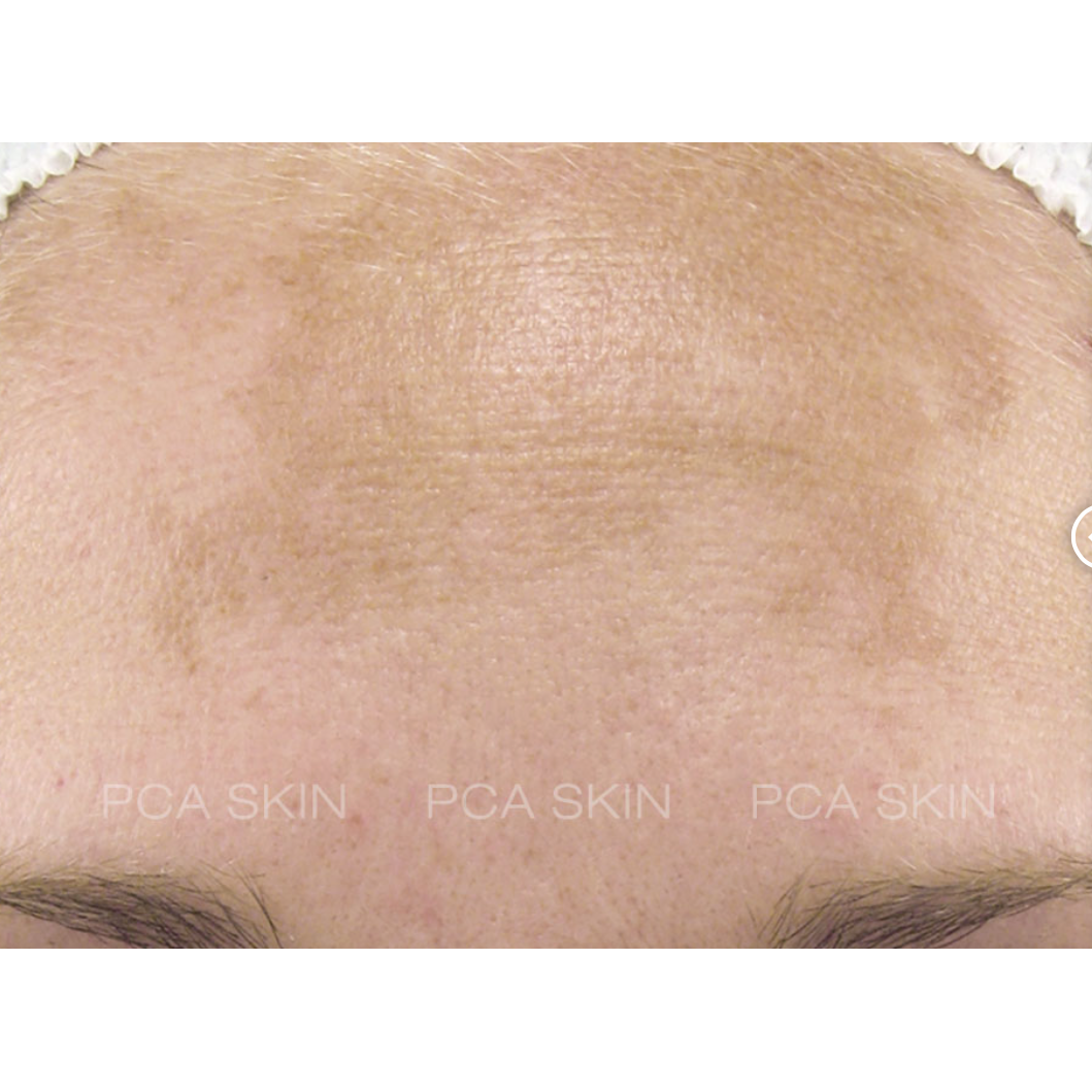 pca skin intensive brightening treatment pure retinol night voor