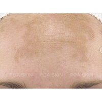 pca skin intensive brightening treatment pure retinol night voor